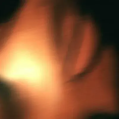 ERRK