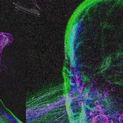 JXXPSINNXR