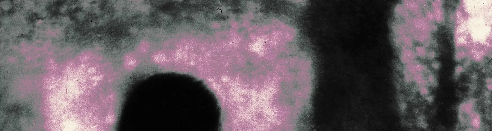1ODUM DEFECT